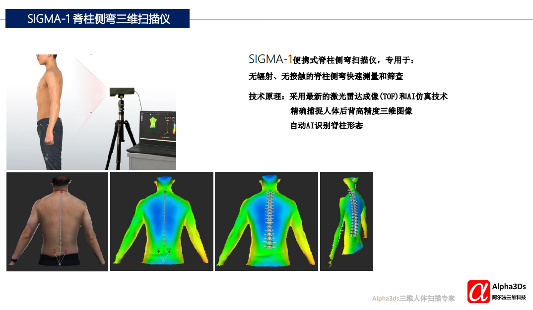 SIGMA-1 便攜式脊柱側彎三維掃描儀