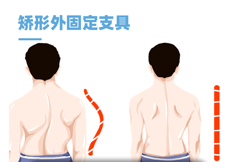 矯形支具-