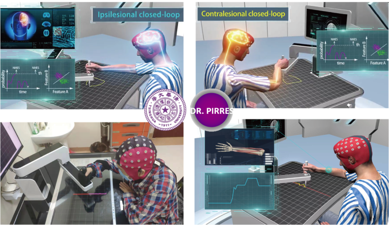 智能精準康復機器人專家系統-